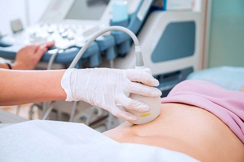 Ovarian ultrasound: What you need to know