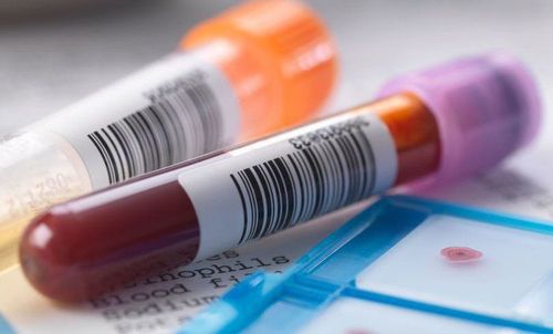 Blood test to check hormone levels of Gastrin