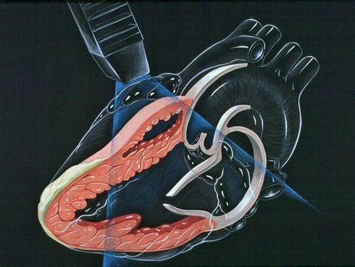 Doppler echocardiography procedure