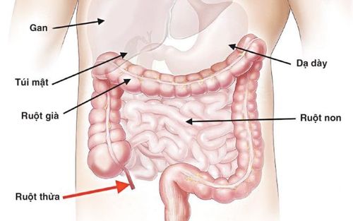 
Vị trí ruột thừa trong ổ bụng
