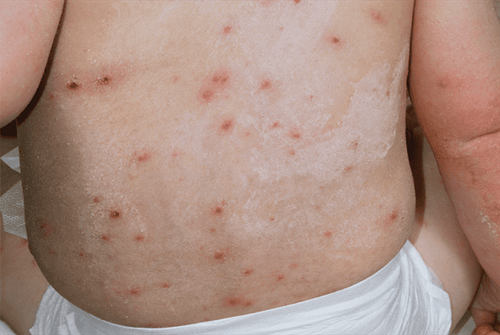 
Sức đề kháng yếu là điều kiện thuận lợi để virus tấn công
