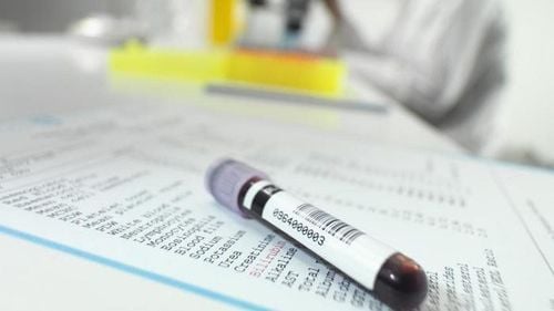 HBeAb test in the diagnosis of hepatitis B