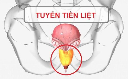 Quy trình chụp cộng hưởng từ tuyến tiền liệt có tiêm thuốc đối quang từ