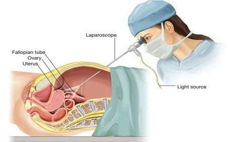 Laparoscopic diagnosis and treatment of blunt abdominal trauma