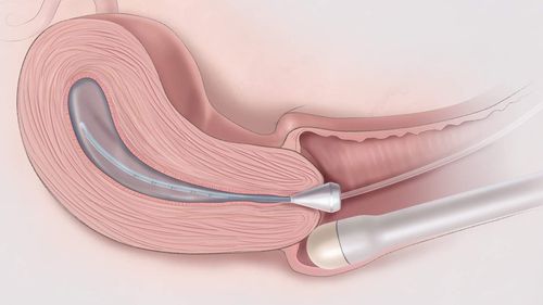 The role of transvaginal ultrasound in the diagnosis of gynecological pathology