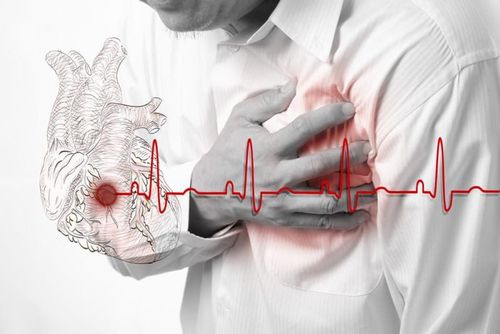 Suy tim mạn và bệnh mạch vành ở người bị mắc phổi tắc nghẽn mạn tính COPD