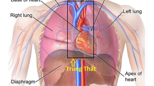 Phẫu thuật nội soi lồng ngực cắt u trung thất nhỏ (<5cm)