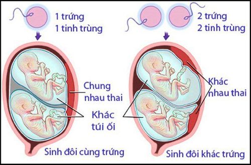 
Sinh đôi cùng trứng và khác trứng
