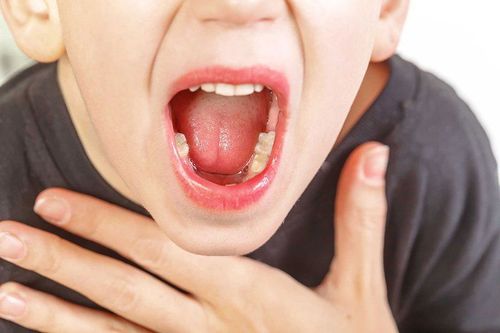 Vướng họng khi không nuốt là dấu hiệu của bệnh lý gì?
