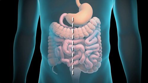 Find out the condition of semi-obstruction of intestine after surgery