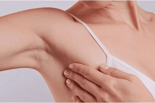 After giving birth, do you need to see a doctor for lymph nodes in the armpit?