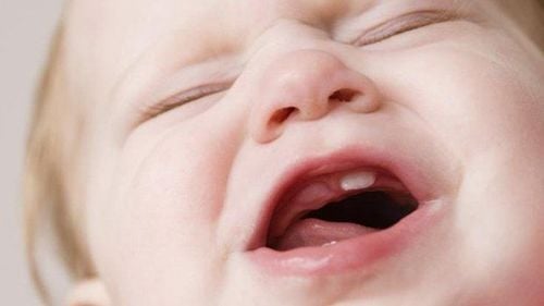What is called delayed teething?