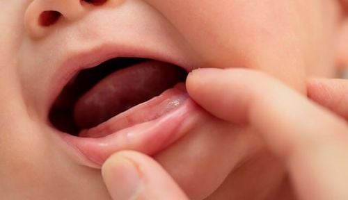 Trẻ 12 tháng tuổi chưa mọc răng có phải bị bệnh gì không?