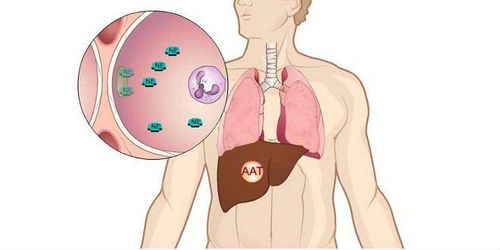 What health problems does alpha 1 antitrypsin deficiency cause?