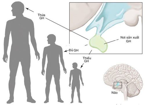 
Tuyến yên là nơi sản sinh ra Hormone tăng trưởng GH
