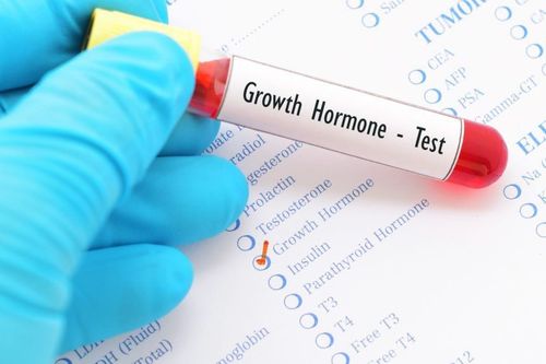 The role of growth hormone (GH) testing