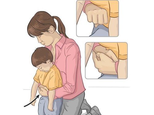 
Động tác ép bụng (cơ động Heimlich)
