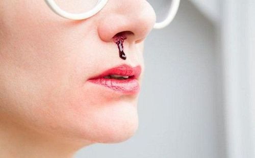 Nosebleeds in adults: What you need to know