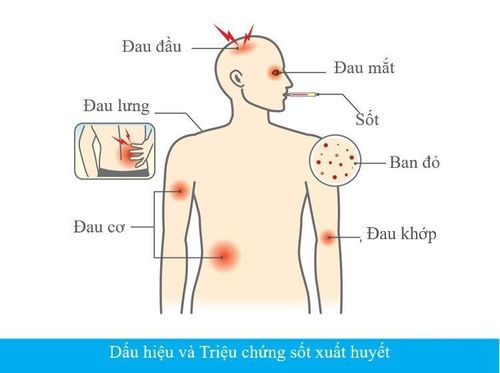 
Mất nước là một trong các biến chứng do sốt xuất huyết gây ra
