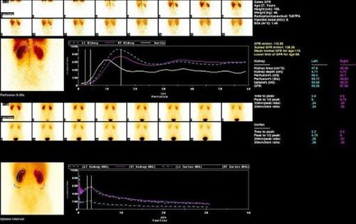 Is kidney scan dangerous?