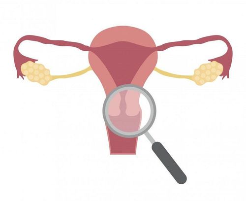 Cervical cancer screening