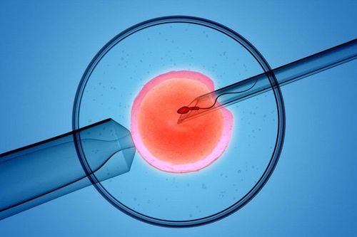 Techniques that can be used during IVF