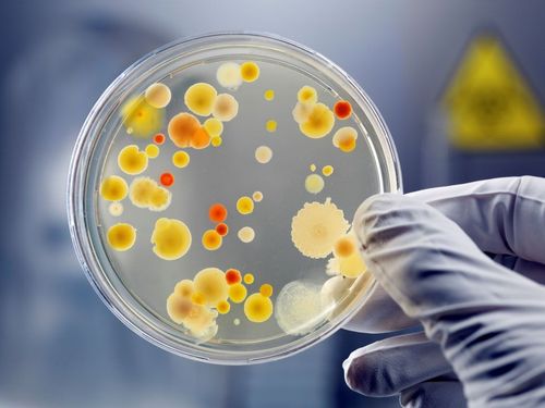 Identification of bacteria growing in culture media