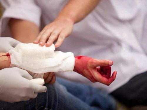 Note when you need to stop bleeding quickly