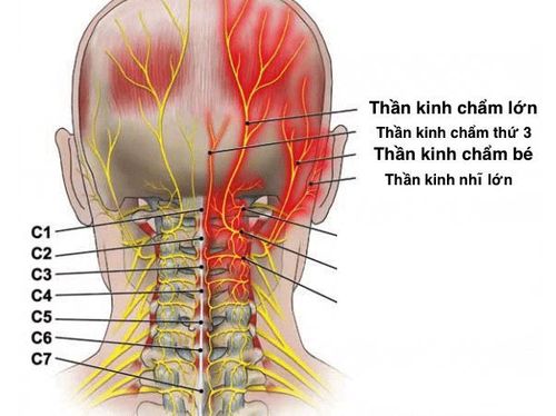 
Đau dây thần kinh chẩm là một nguyên nhân phổ biến gây đau đầu
