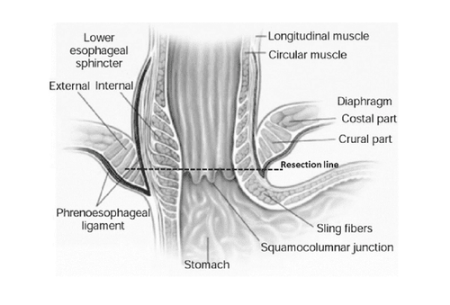 Esophageal anatomy pictures