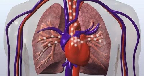 How can lupus affect your heart and lungs?