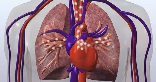 Lupus có thể ảnh hưởng đến tim và phổi của bạn như thế nào?