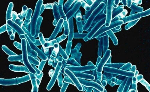 
Vi khuẩn lao màng bụng Mycobacterium tuberculosis
