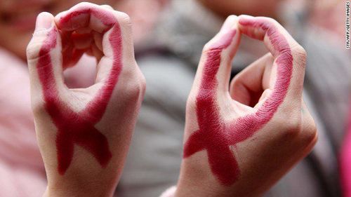 
Nhiễm HIV tiến triển gây nên nhiễm trùng
