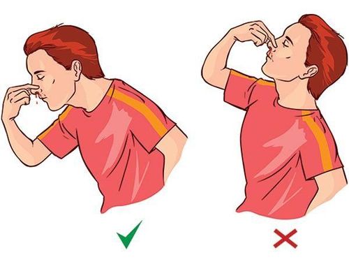 Correct first aid when nosebleed