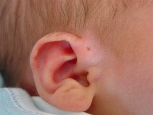 Trẻ hơn 1 tháng tuổi có thể đo thính lực được nữa không?