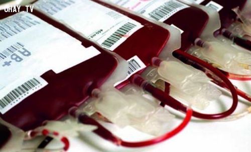 Some important points in bulk blood transfusion