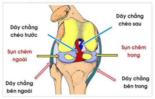 Đứt dây chằng chéo đầu gối: Cần xử lý sớm, tránh biến chứng nặng