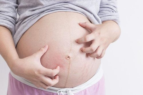 How to prevent stomach itching during pregnancy