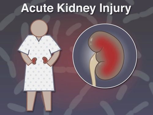 Learn about acute kidney injury (AKI)