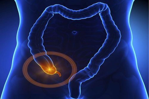 Common types of appendicitis