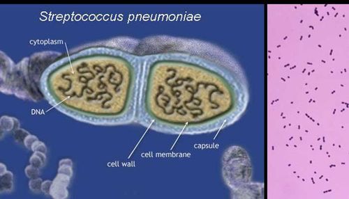 What is Pneumococcal S.pneumoniae?