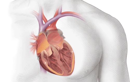 Learn about atrial malformations