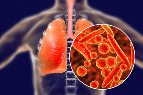 TB bacteria characteristics