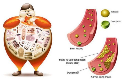 Cholesterol ở trẻ em: Những điều cần biết