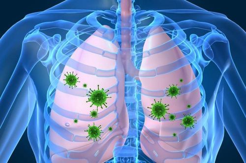 Reasons for easy bacterial pneumonia after viral infection