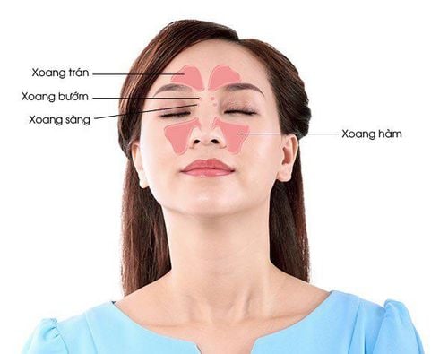 Viêm xoang trán: Những điều cần biết