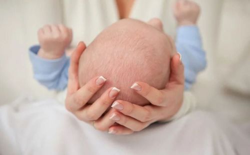 Bulging fontanelles in babies: What you need to know