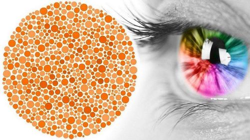 Causes of color blindness