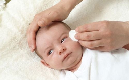 Newborn eye exam